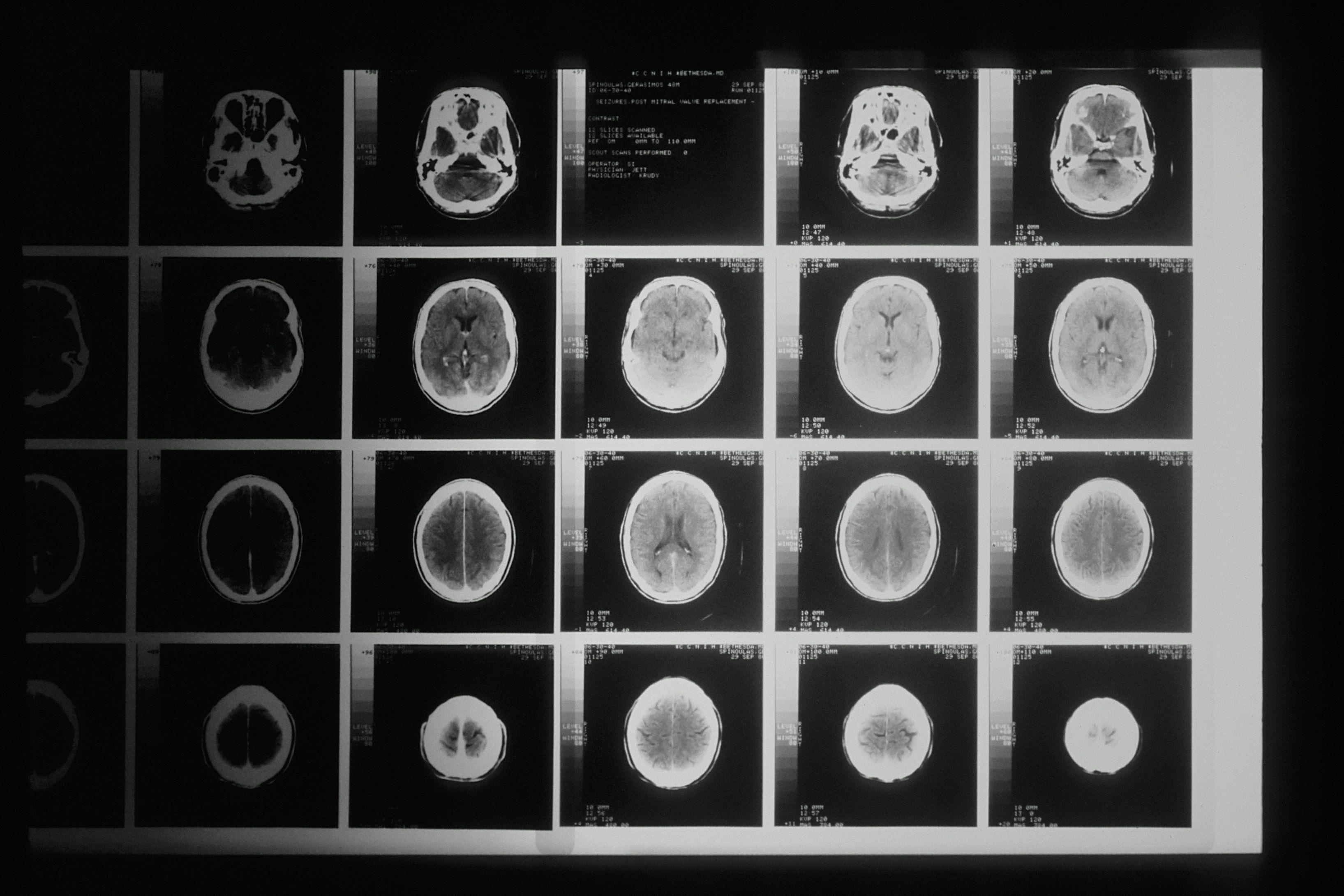 Expanding Frontiers: Medical Imaging AI M&A Opportunities